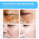 NIDA Skin Revival &mdash; відновлювальний крем для обличчя з центелою, 100 мл