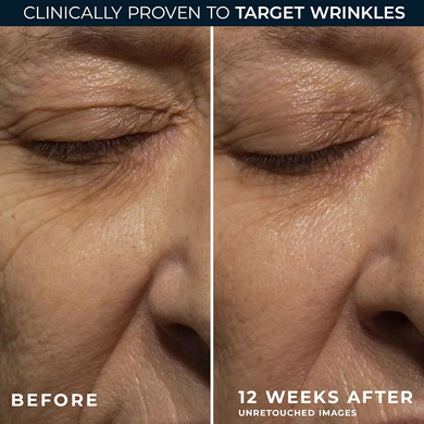 RoC Retinol Correxion Wrinkle Correct Night Cream &mdash; Нічний крем для обличчя з ретинолом, 30ml