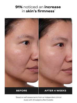 Paula&rsquo;s Choice Clinical 1% Retinol Treatment &mdash; крем-сироватка для обличчя з 1% ретинолу, 30ml