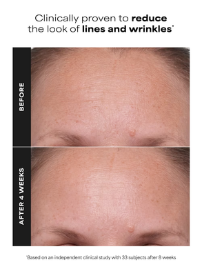 Paula&rsquo;s Choice Clinical 1% Retinol Treatment &mdash; крем-сироватка для обличчя з 1% ретинолу, 30ml