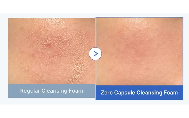 Medicube Zero Pore SA Clear Capsule Cleansing Foam &mdash; очищающая пенка для лица с кислотами, 120 г
